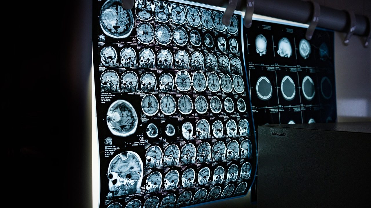 A researcher examines colorful brain scan images displayed on a monitor in a laboratory setting.